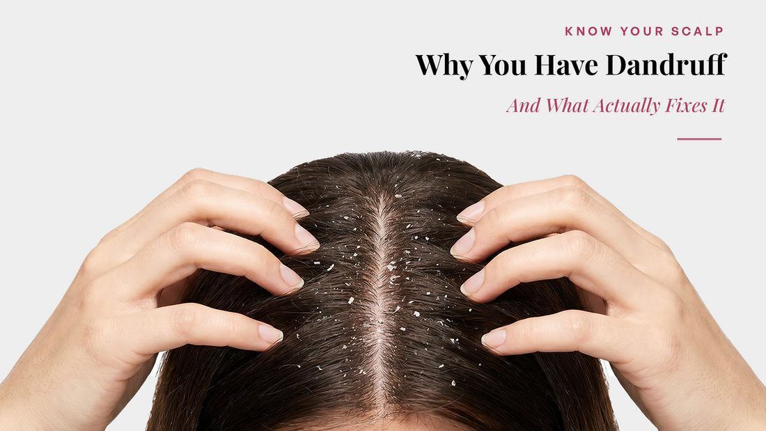 Why You Have Dandruff — And What Actually Fixes It